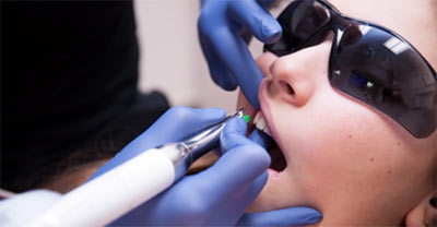 Painelss Freezing treatment at Magic Dental